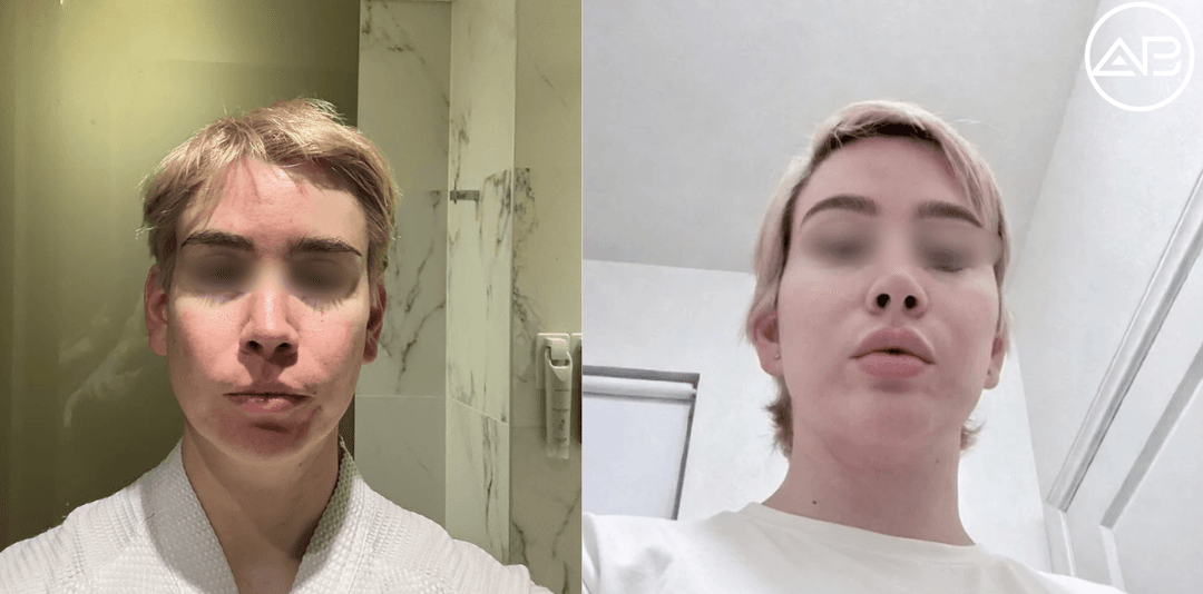 AB Plastic Surgery