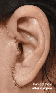 Skill matters in post-surgery scarring too. 2