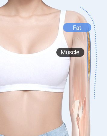 Fat and muscle after precise diagnosis