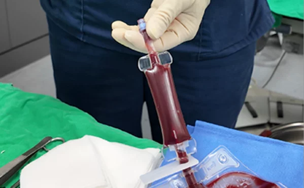 필터를 활용허여 불순물 제거