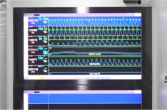 Central Monitoring System