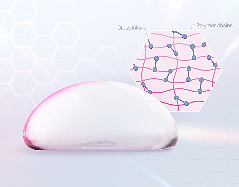 Mentor Breast Implants Surgery AB Plastic Surgery