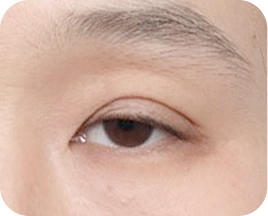 The Key to Beautiful Eyes