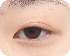 The Key to Beautiful Eyes