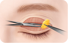 surgery_illust