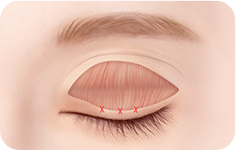surgery_illust