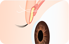 surgery_illust