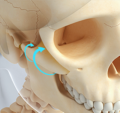 Rotation and Repositioning Inward and Posterior-Superiorly