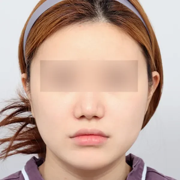 Before case 6