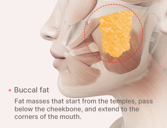 More Contoured: Removal of Buccal Fat