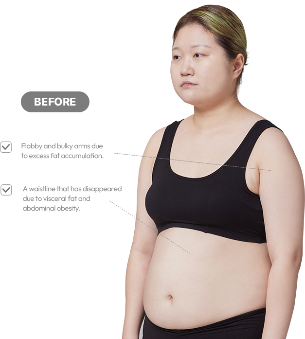 맥미걸 악플콜렉터 바디 수술 전 문제점과 개선점