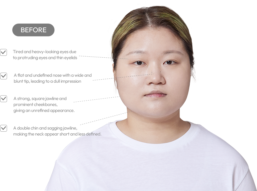 맥미걸 악플콜렉터 얼굴 수술 전 문제점과 개선점