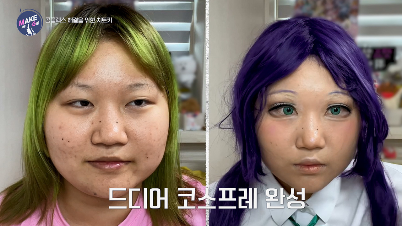 맥미걸 MAKE ME GIRL 수술 전