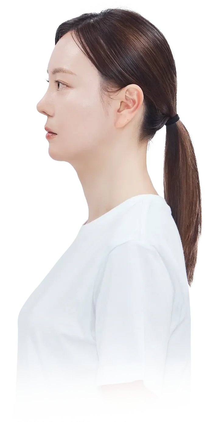 맥미걸 악플콜렉터 수술 후 변화