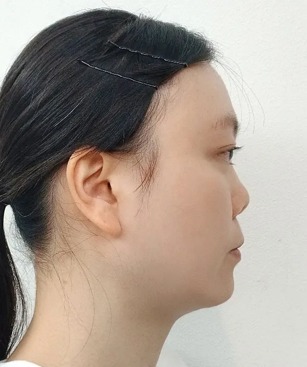 맥미걸 악플콜렉터 Before후 사진