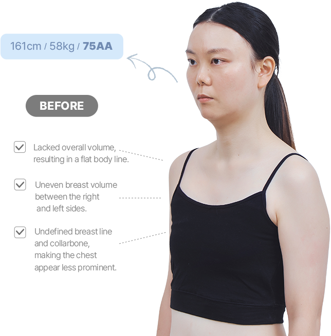 맥미걸 악플콜렉터 바디 수술 전 문제점과 개선점