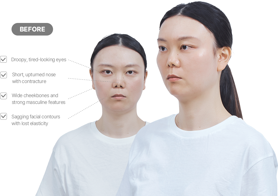 맥미걸 악플콜렉터 얼굴 수술 전 문제점과 개선점