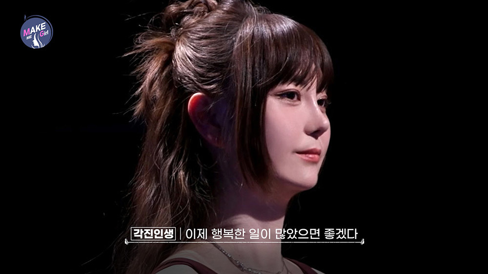 맥미걸 MAKE ME GIRL 수술 후