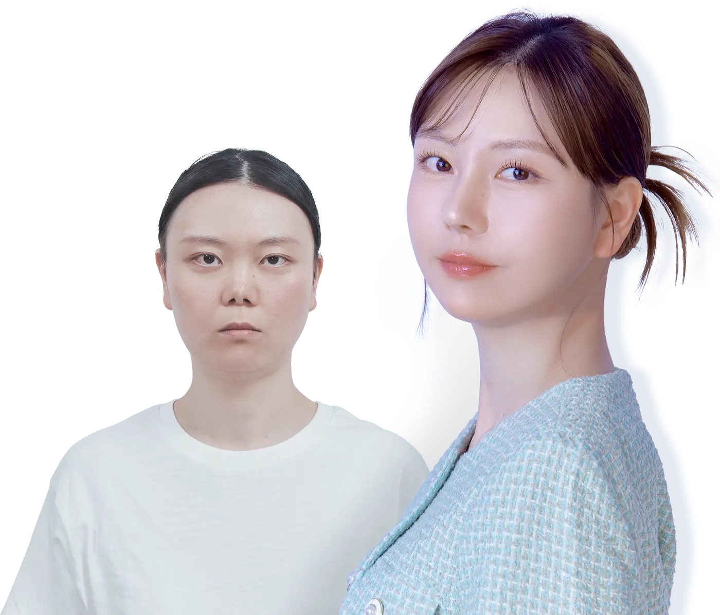 맥미걸 악플콜렉터 수술 전후 사진