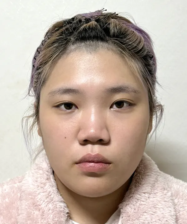 맥미걸 악플콜렉터 Before후 사진