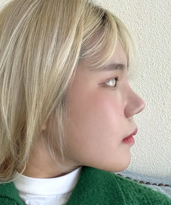 맥미걸 악플콜렉터 Before후 사진