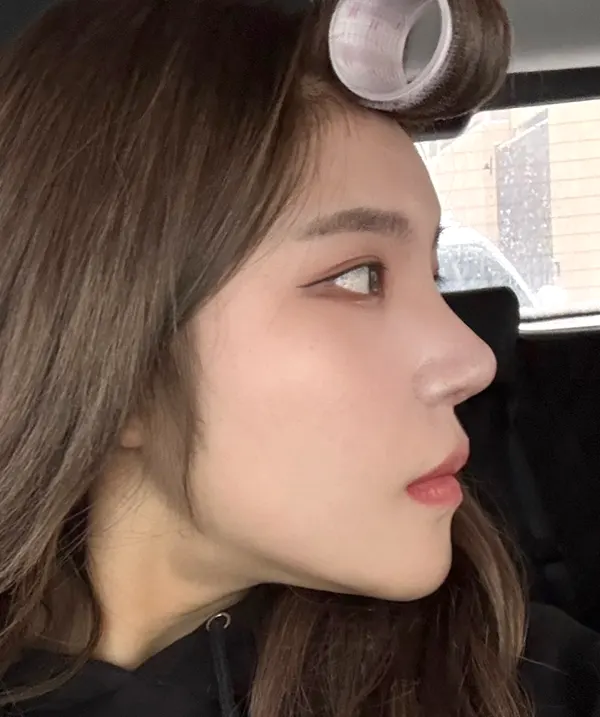 맥미걸 악플콜렉터 Before후 사진