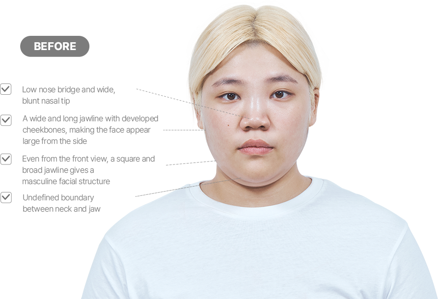 맥미걸 악플콜렉터 얼굴 수술 전 문제점과 개선점