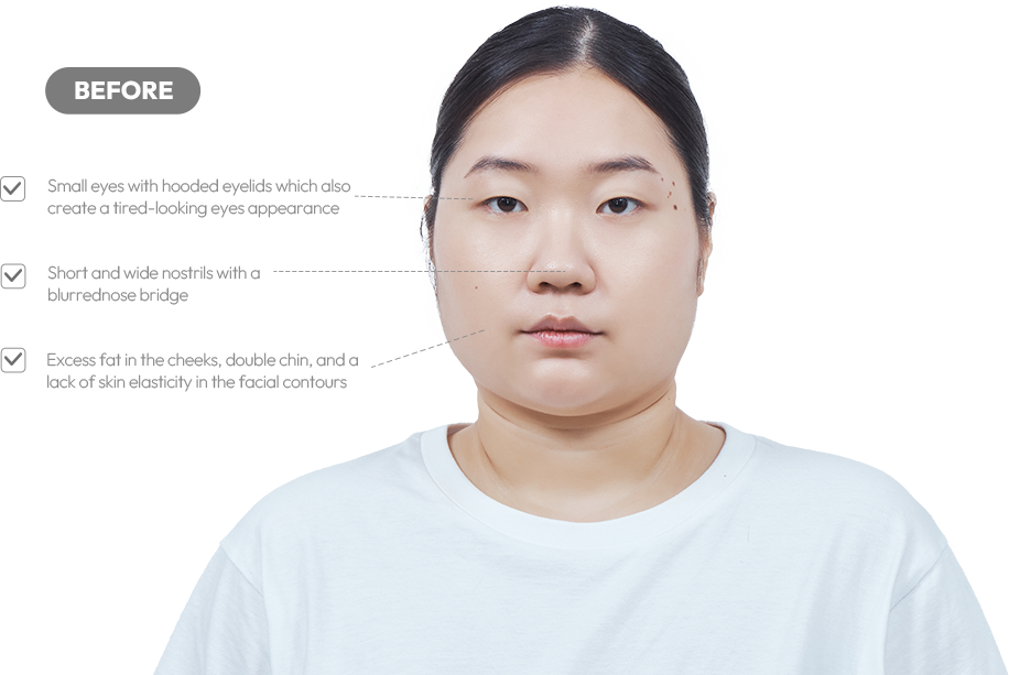 맥미걸 악플콜렉터 얼굴 수술 전 문제점과 개선점