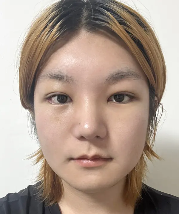 맥미걸 악플콜렉터 Before후 사진