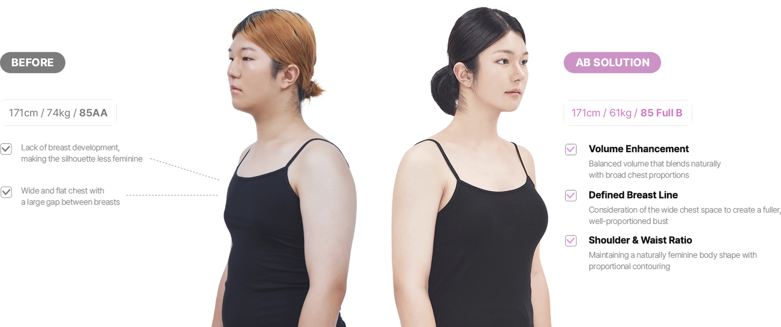 맥미걸 악플콜렉터 얼굴 수술 전 문제점과 개선점