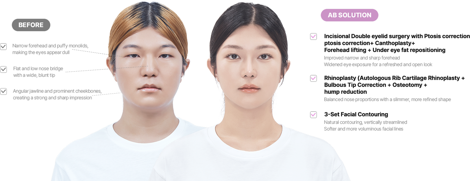 맥미걸 악플콜렉터 얼굴 수술 전 문제점과 개선점