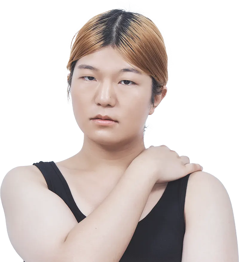 맥미걸 악플콜렉터 수술 전 사진