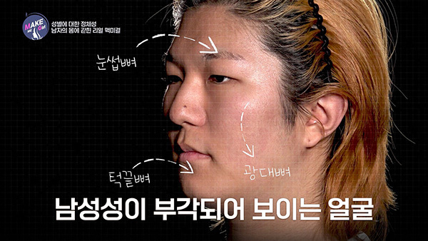 맥미걸 MAKE ME GIRL 수술 전