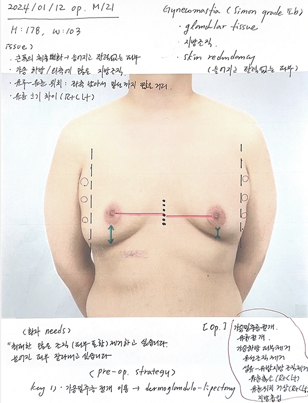surgery memo