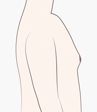 surgery_illust