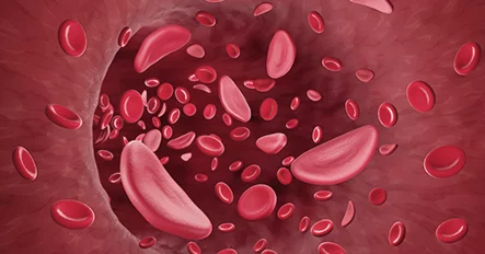 Blood-derived Stem Cell Injection