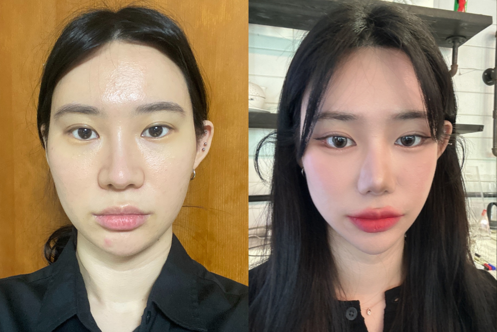 Emerging Trends in Korean Plastic Surgery