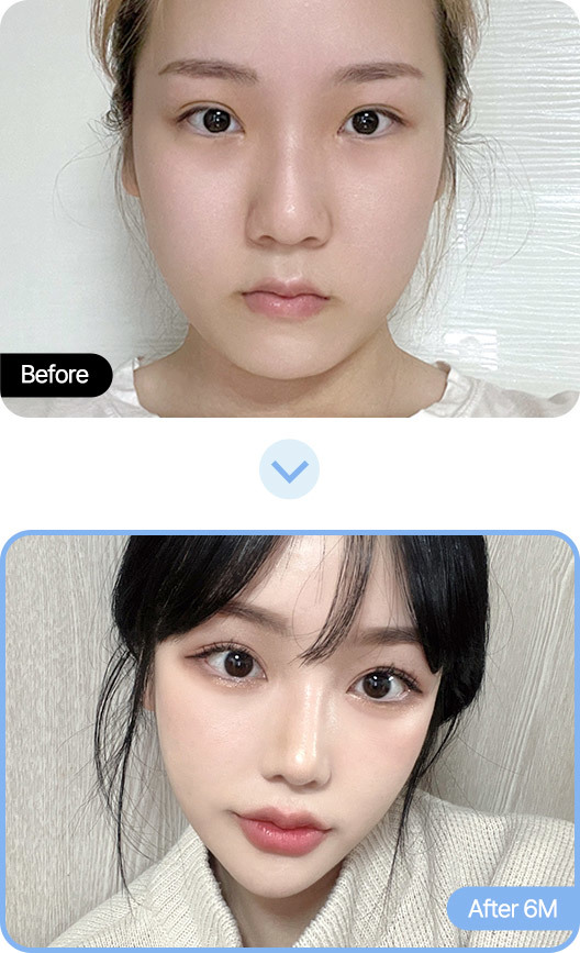 Results of the Safe Plastic Surgery at AB Plastic Surgery Korea