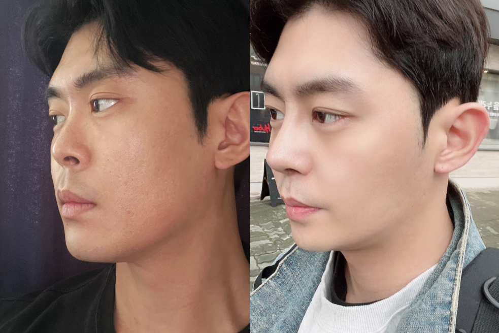 Male Plastic Surgery at AB