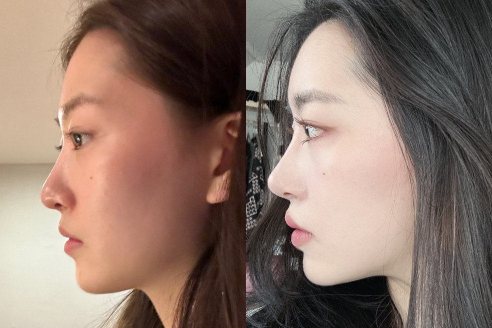  Korean Plastic Surgery Trends