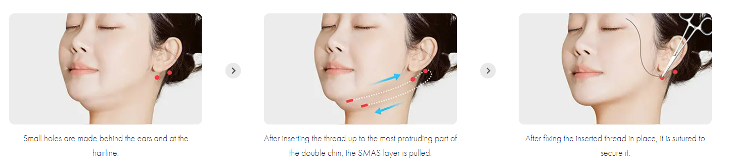 How to Get Rid of Double Chin 