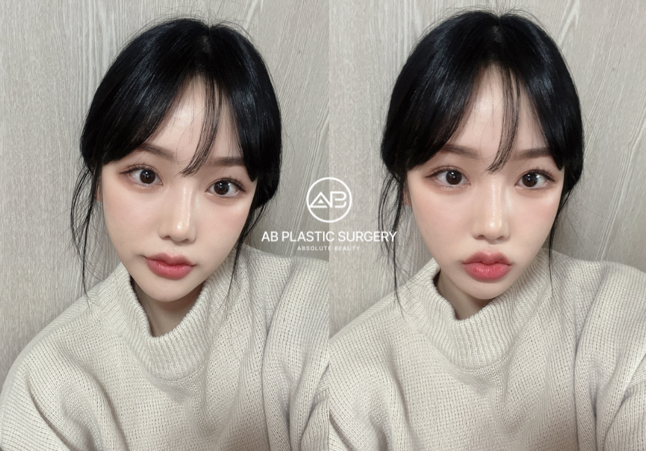 korean-beauty-standards-glass-skin