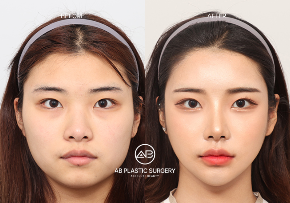 korean-beauty-standards-small-face