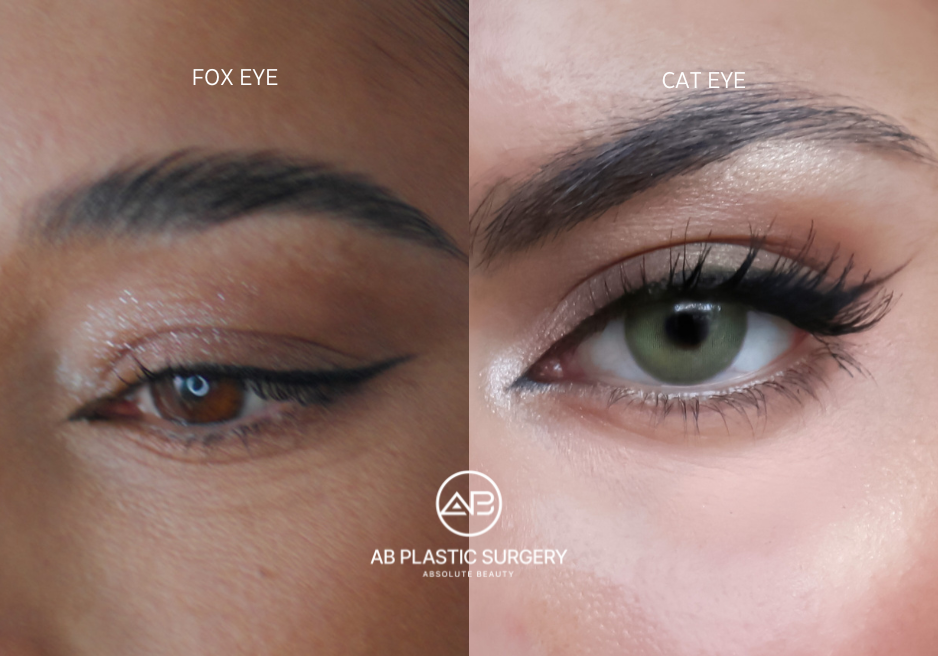 cat-eye-vs-fox-eye-surgery