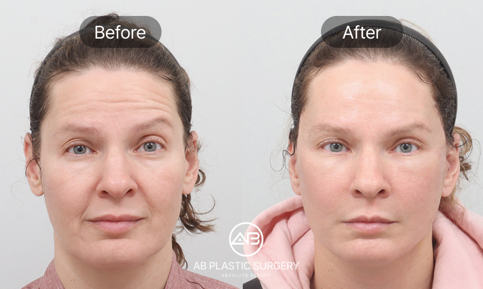 why-choose-korean-plastic-surgery