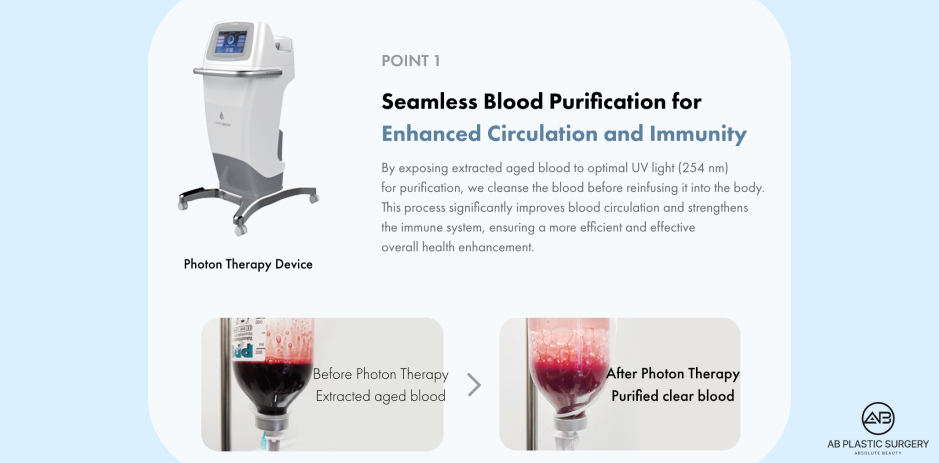 UV blood purification before and after, AB Plastic Surgery Korea Inner Cell Therapy system