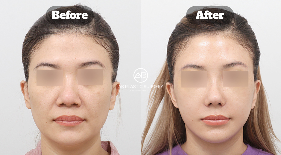 Stem cell treatments expected to gain greater attention in 2026