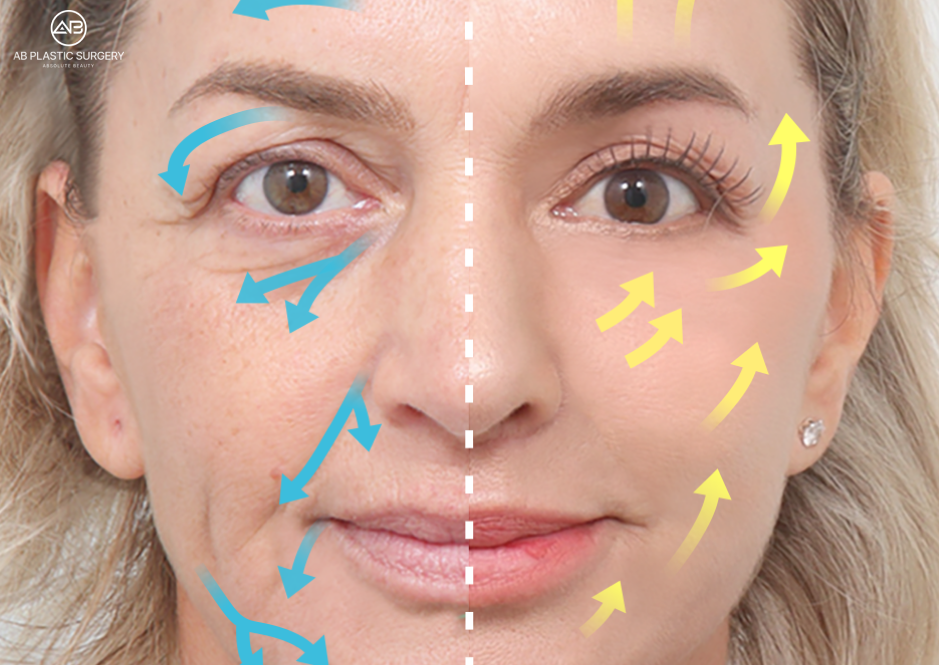 Main Causes of Skin Laxity and Loss of Facial Elasticity Due to Aging