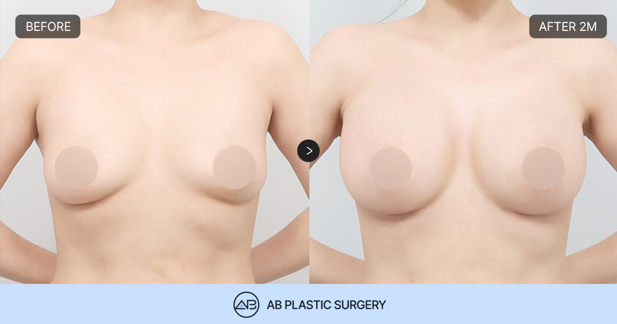 AB Plastic Surgery