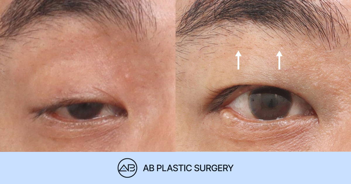 AB Plastic Surgery